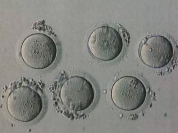 <b>别还不知道养囊胚风险有多大，10个胚胎只能养成这几个</b>